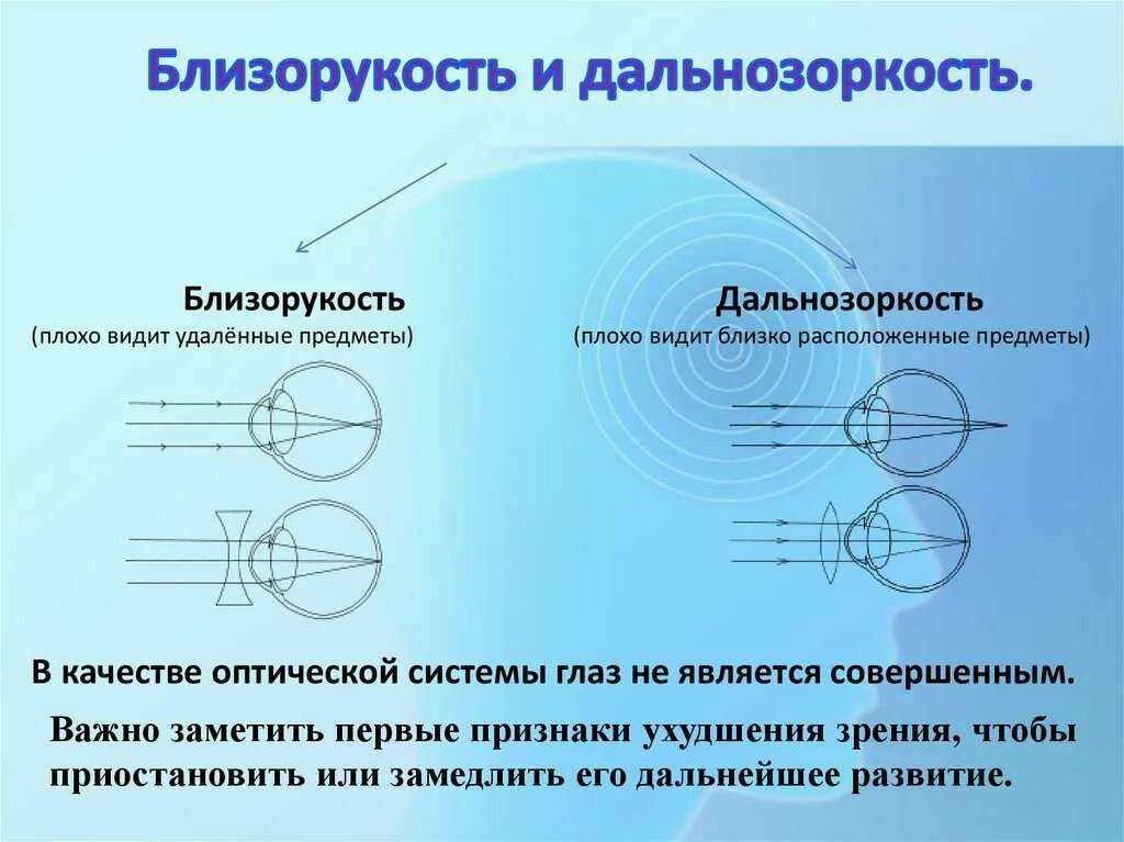 Дальнозорким людям необходимо использовать очки так как