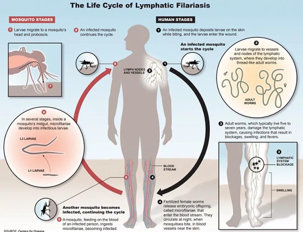 Wuchereria bancrofti жизненный цикл. Филяриатозы заболевания. Жизненный цикл вухерерии. Филяриатозы жизненный цикл.