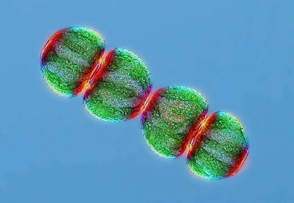 Водоросли хромосомы. Хромосомы микрофотография. Микрофотографии микробов. Микро картинки. !Микрофотография природа.