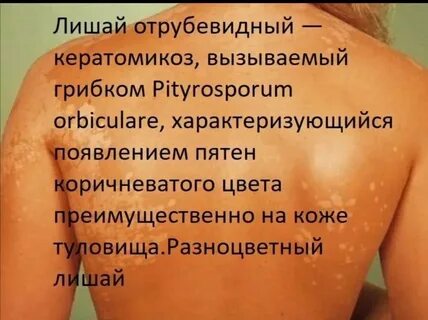 Чем лечить разноцветный
