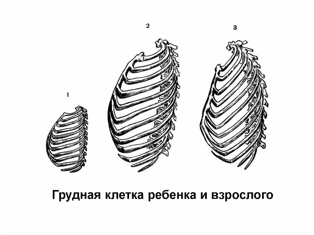 Форма грудной клетки у новорожденного. Килевидное строение грудной клетки. Килевидная форма грудной клетки. Строение грудной клетки у грудничка. Грудная клетка у ребенка норма