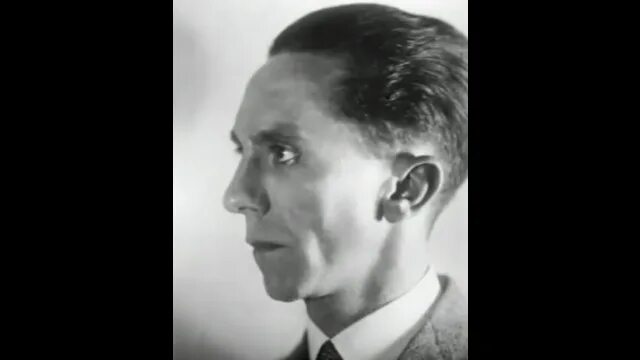 Before And After Surgery Goebbels Chin Edits Know Your Meme