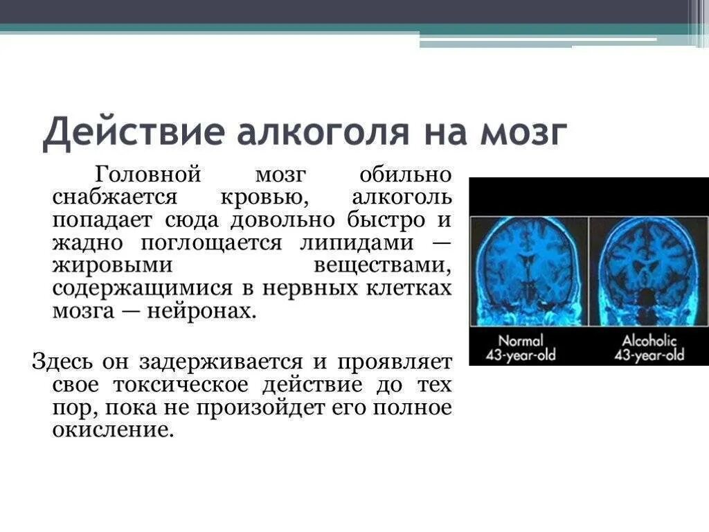 Нейроны головного мозга и алкоголь.