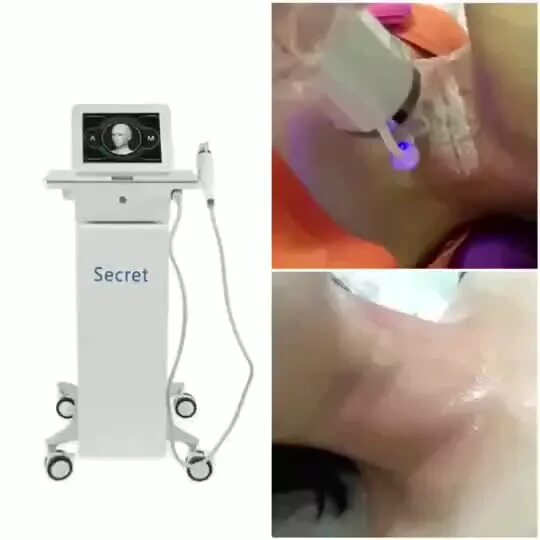 Игольчатый rf цена skinlift ru. Микроигольчатый RF-лифтинг аппарат Secret. Аппарат микроигольчатого RF лифтинга Secret. Аппарат HIFU hello Skin h-022. Аппарат Secret RF Lifting.