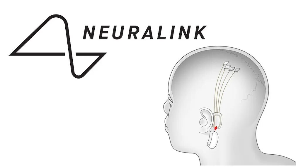 Илон маск имплант. Neuralink чип. Neuralink Musk. Логотип компании Neuralink.