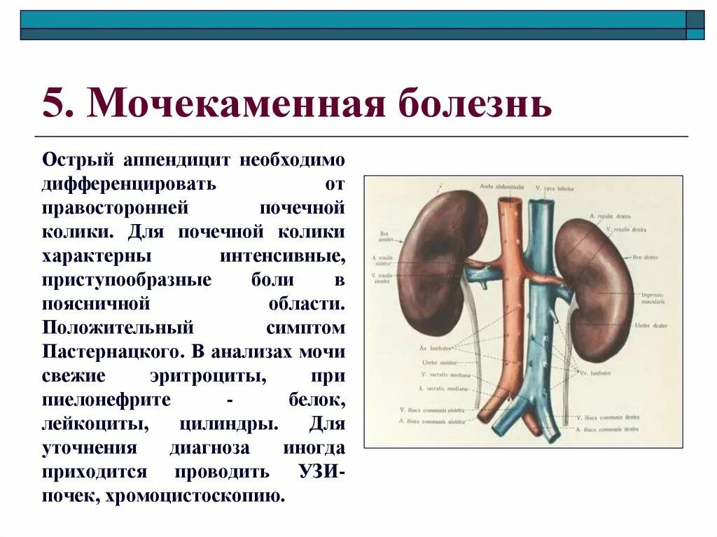 Мочекаменная болезнь колики