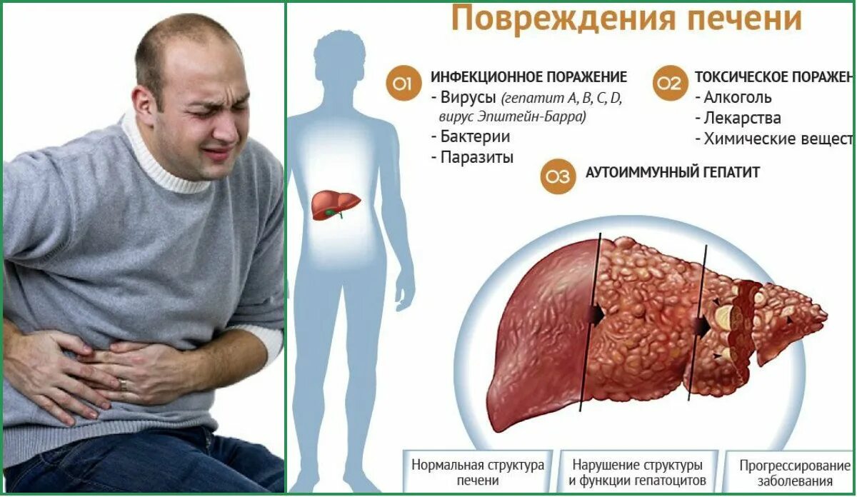 Сколько живут с циррозом печени при гепатите. Сколько живут с циррозом печени при гепатите