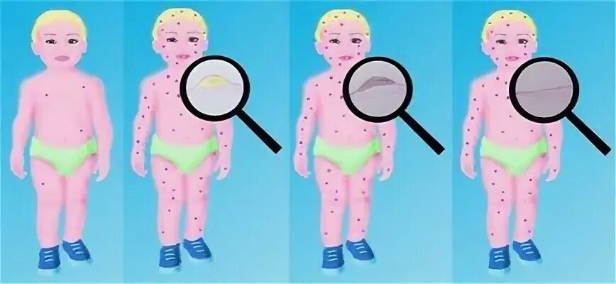 بالصور : #أظافرك تخبرك عن حالتك الصحية http://www.dailymedicalinfo.com/?p=892 #ص