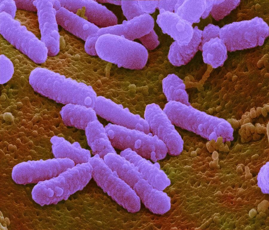 Coli sotwe. Бактерия Escherichia coli. Кишечная палочка Escherichia coli. Бактерия кишечной палочки Escherichia coli. Бактерии эшерихия коли.