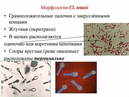 Микобактерии туберкулеза грамотрицательные