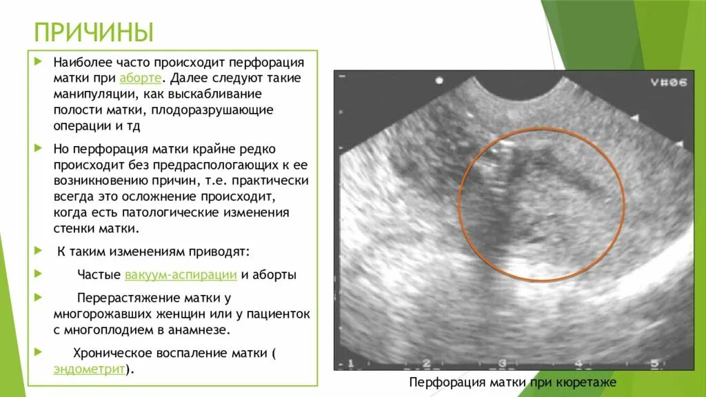 Месячные после удаления эндометрия