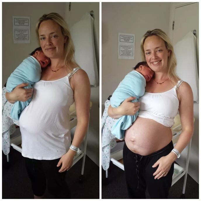 39 недель постоянно. Фотосессия женщин после родов. Женщины беременные двойней.
