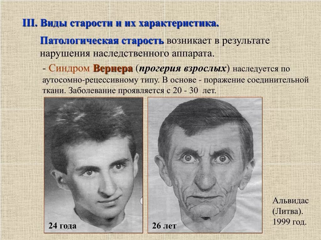 Синдром средних лет. Прогерия взрослых синдром вернера. наследственные заболевания прогерия. болезнь преждевременного старения. генетическое заболевание преждевременное старение.