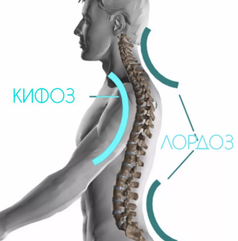Лордоз и кифоз позвоночника. Сколиоз кифоз лордоз шейного отдела. Изгибы позвоночника лордоз и кифоз. Гиперлордоз шейного отдела позвоночника. Изгиб позвоночника назад