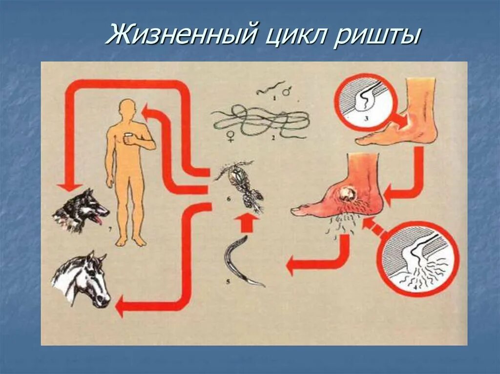 Как человек заражается паразитами
