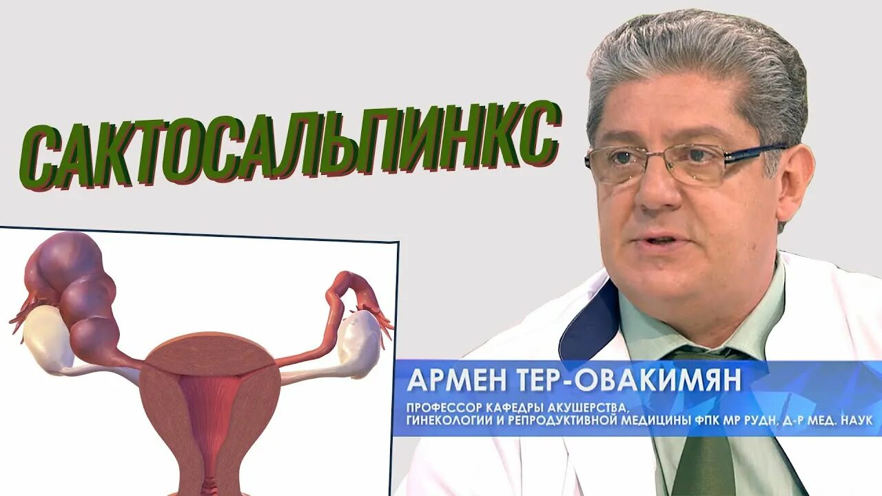 Гидросальпинкс что это такое как лечить