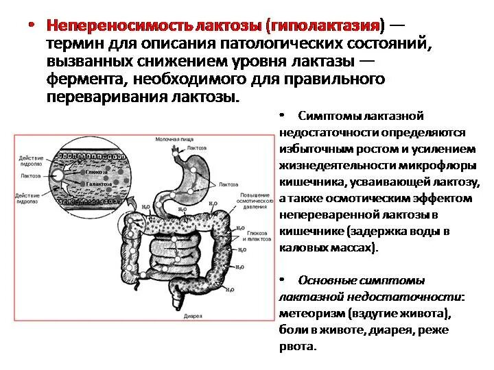 Лактоза усваивается организмом. Неперенсоимостьлктозы. Непереносимость лактозы. Непереносимость лактозы симптомы. Непереносимость лактозы симптомы у детей.