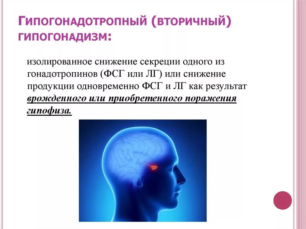 Гипогонадотропный гипогонадизм у мужчин. Первичный и вторичный гипогонадизм у женщин. Гипогонадизм диагноз. Гипогонадизм механизмы развития. Гипергонадотропного гипогонадизма.