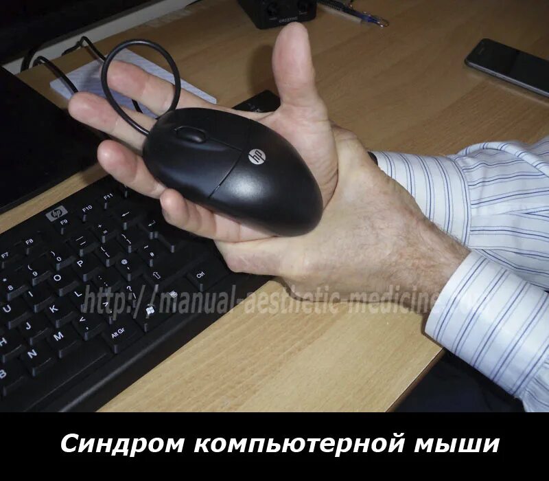 синдром компьютерной мыши. болезнь запястья от компьютерной мышки. синдром мышки компьютерной. синдром запястного канала от компьютерной мышки. болезнь кисти руки от компьютерной мыши.