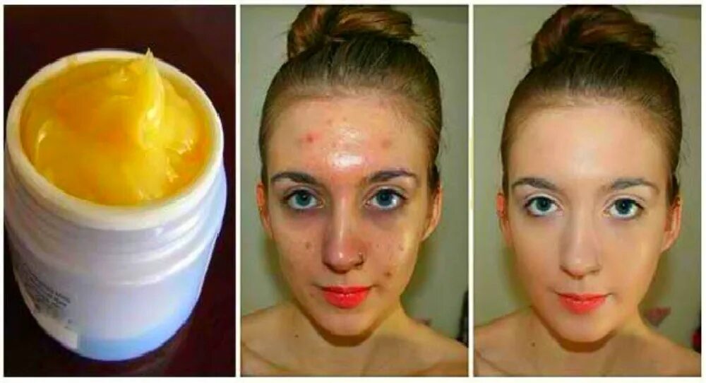 после тканевой маски надо мыть лицо. маска после чистки лица. корейская маска до после. после масок липкое лицо. маска от покраснений на лице.