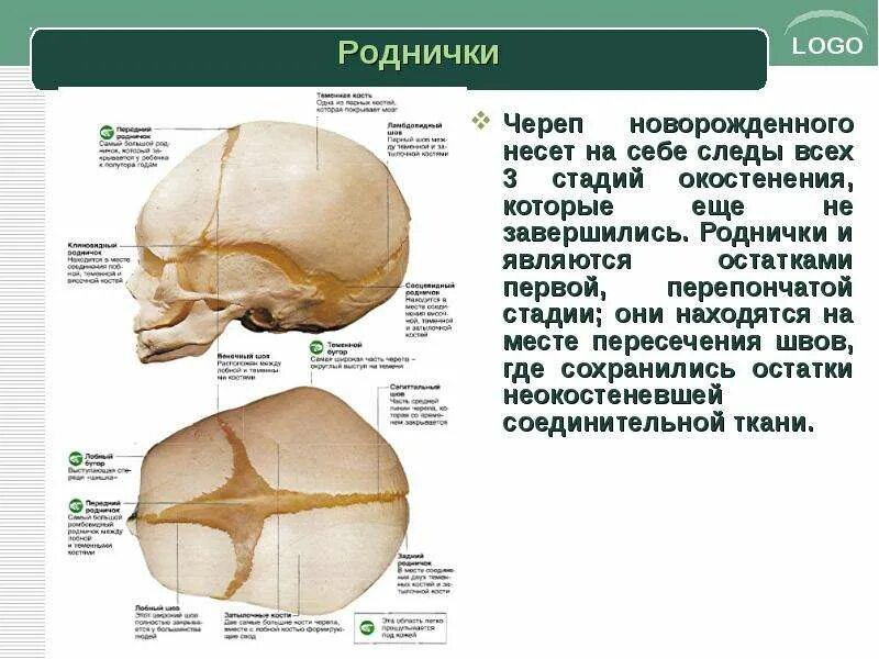 Роднички какие. Роднички у детей анатомия. Темечко на черепе. Роднички черепа. Роднички черепа новорожденных.