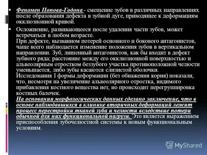 Феномен годона