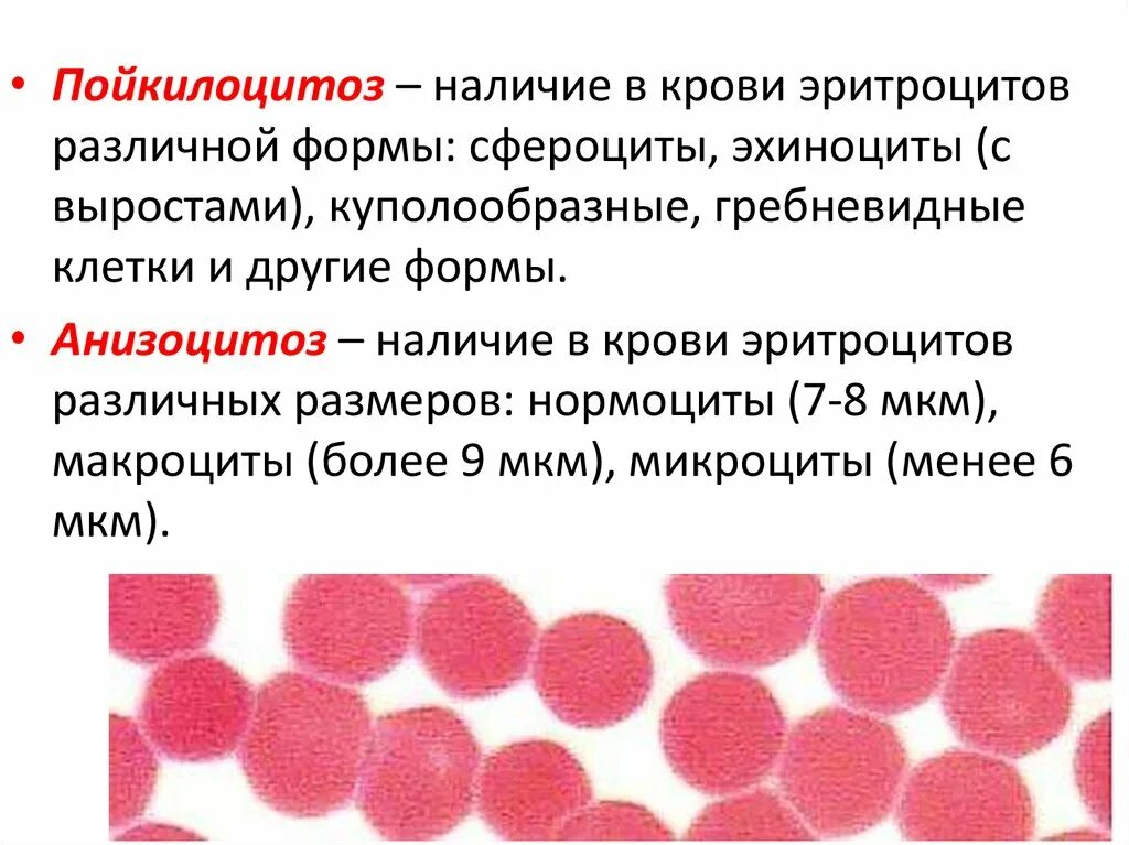 При каком заболевании эритроцитов. Пойкилоцитоз формы эритроцитов. Анизо и пойкилоцитоз. Патологические формы эритроцитов пойкилоцитоз. Изменение формы эритроцитов (пойкилоцитоз).