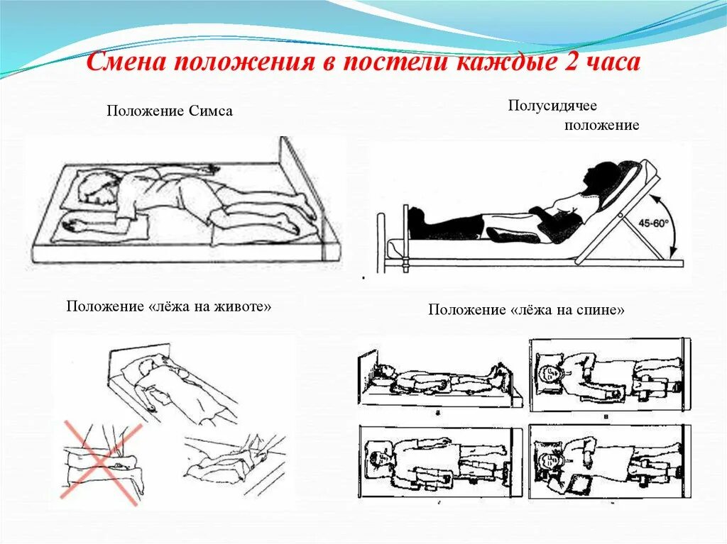 Положение пациента при пролежнях