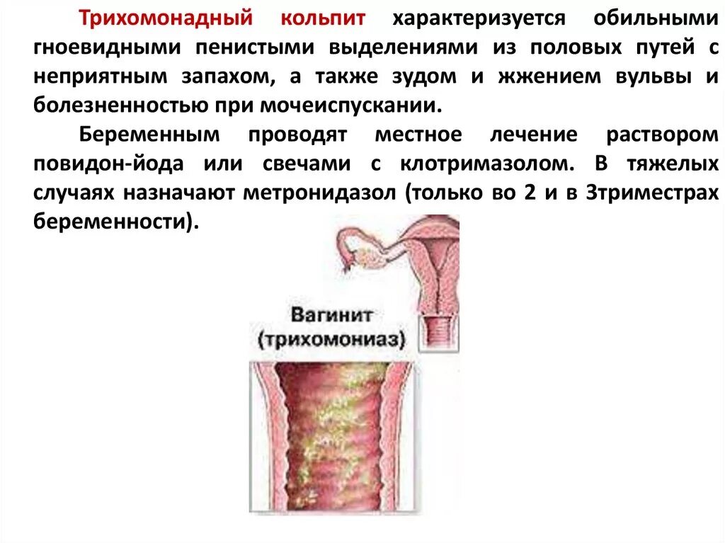 Клинические симптомы трихомонадного кольпита. Трихомонадный кольпит факторы риска. Клинические симптомы микотического кольпита. Трихомонадный вульвовагинит клинические проявления.