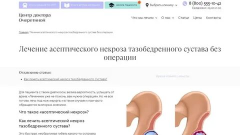 Остеонекроз лечение