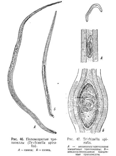 Трихинелла Спиралис строение личинки. Трихинелла Спиралис капсула. Трихинелла спиральная самец и самка. Trichinella spiralis морфология.