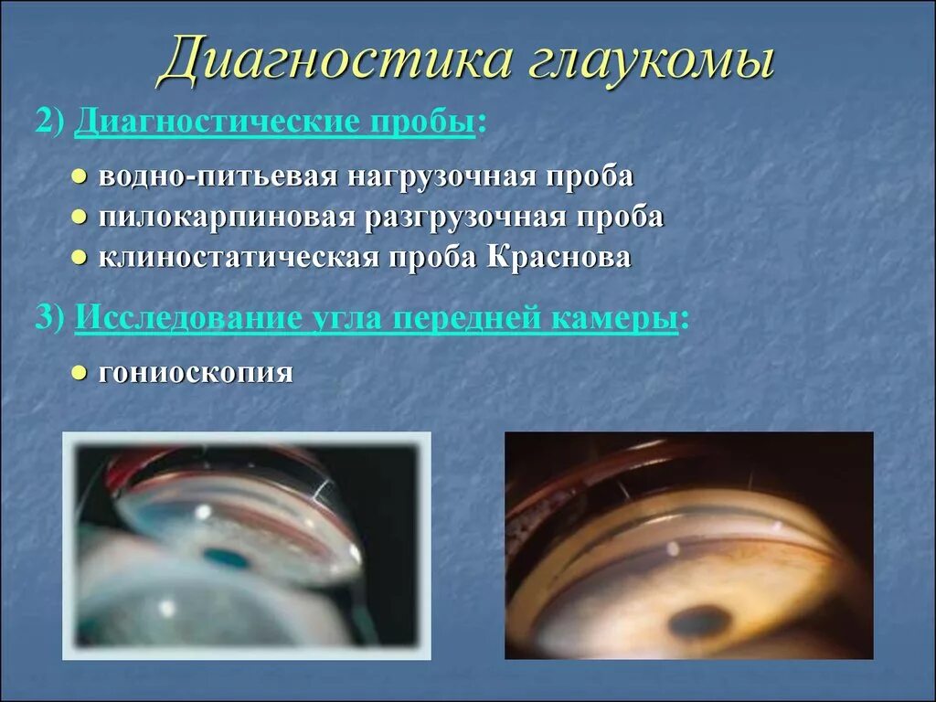 Метод исследования диска зрительного нерва. Ранняя диагностика глаукомы. Лазерная хирургия глаукомы. Критерии диагностики глаукомы. Глаукома низкого давления.