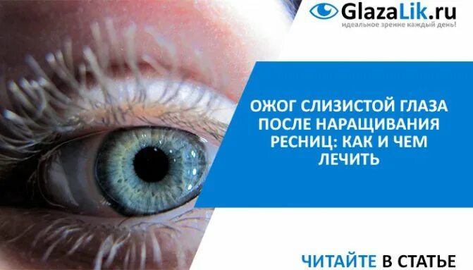 Капли после ресниц. Ожог глаза после наращивания ресниц. Ожог глаза при наращивании ресниц. Ожог роговицы при наращивании ресниц. Капли при ожоге глаз при наращивании ресниц.