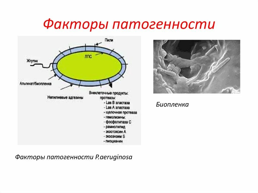 К какой группе патогенности отнесен ковид. Факторы патогенности синегнойной палочки микробиология. Pseudomonas aeruginosa факторы патогенности. Синегнойная палочка факторы патогенности. Факторы патогенности микроорганизмов микробиология таблица.