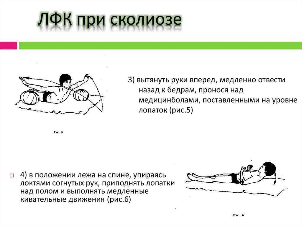 Лечебная гимнастика при сколиозе