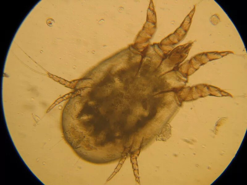 Sarcoptes scabiei