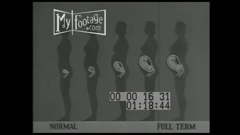 Puberty education boys girls 1991