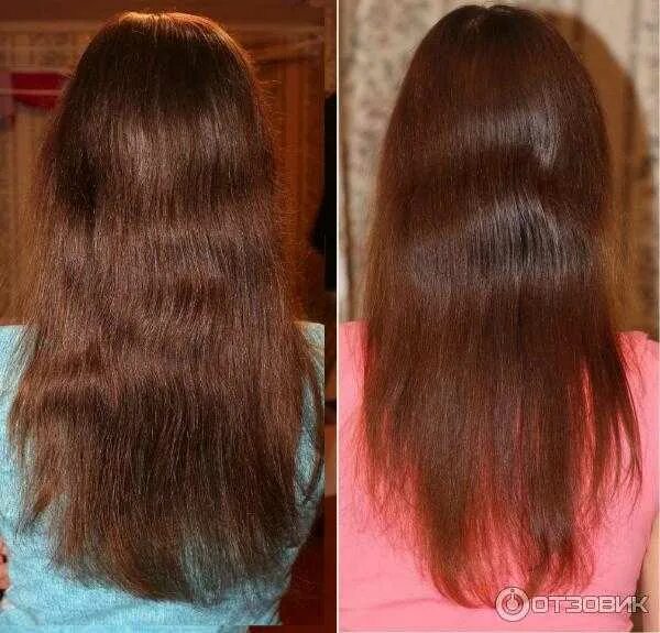 Густые волосы до и после. Восстановление волос за месяц. Восстановление волос от выпадения. Восстановление густоты волос. Восстановление густоты волос отзывы