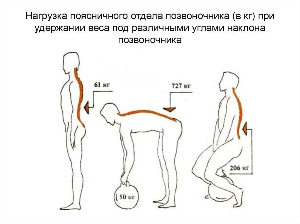 Нагрузка на поясницу. Вертикальная нагрузка на позвоночник. Осевая нагрузка на позвоночник. Нагрузка на позвоночник при наклоне. Нагрузка на шейный отдел.