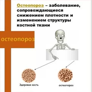 Причины остеопороза