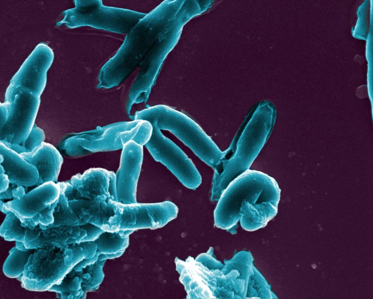 Туберкулезная палочка паразит. Палочка коха (mycobacterium tuberculosis). палочка коха возбудитель туберкулеза. люминесцентная микроскопия палочки коха. бактерия коха под микроскопом.
