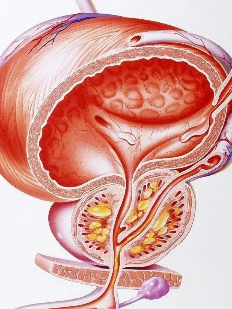 Простата хочет. Анатомия аденомы предстательной железы. Простата и предстательная железа. Доброкачественная гиперплазия предстательной железы. Предстательная железа в 3 д анатомия.
