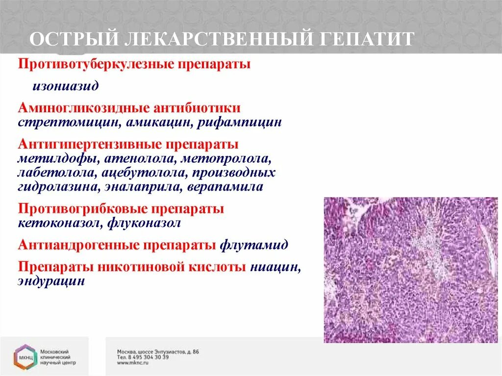 Центр лечения гепатитов. Лечение хронического лекарственного гепатита схема. Токсическое поражение печени гистология. Лекарственно индуцированный гепатит патогенез. Стадии лекарственного поражения печени.