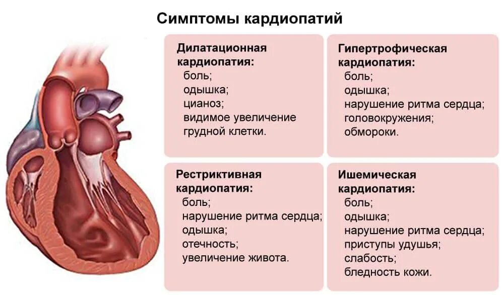 Сердечные заболевания у взрослых