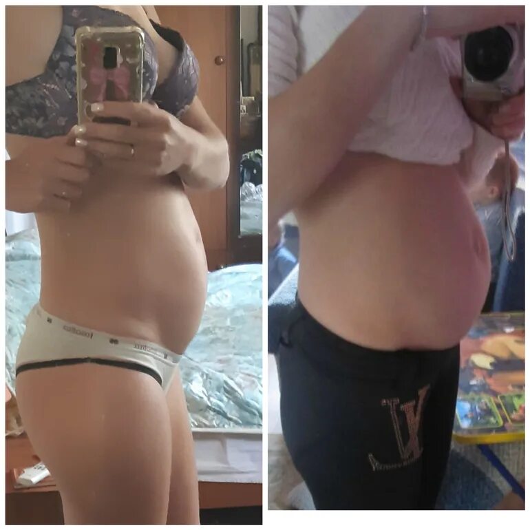 18 неделя близнецов. Живот с двойней на 18 неделе. Живот при беременности 16 недель.