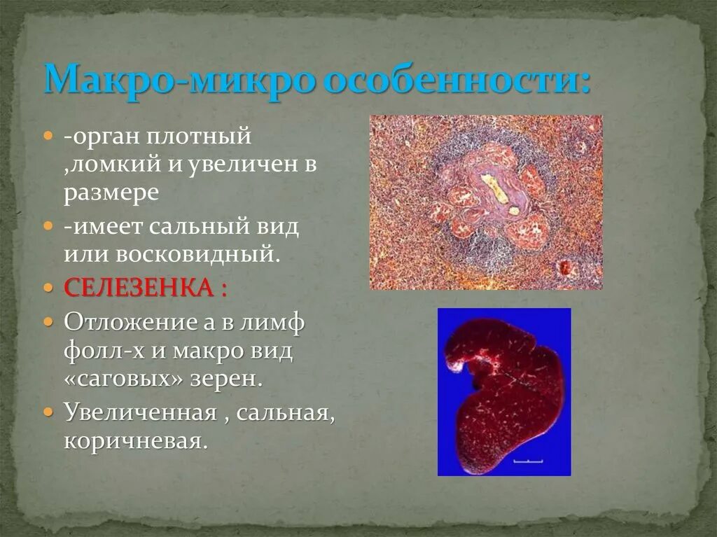 Микро особенность. Макро и микро. макро и микро увеличение. сальная селезёнка макро и микро. микро макро супермакро.