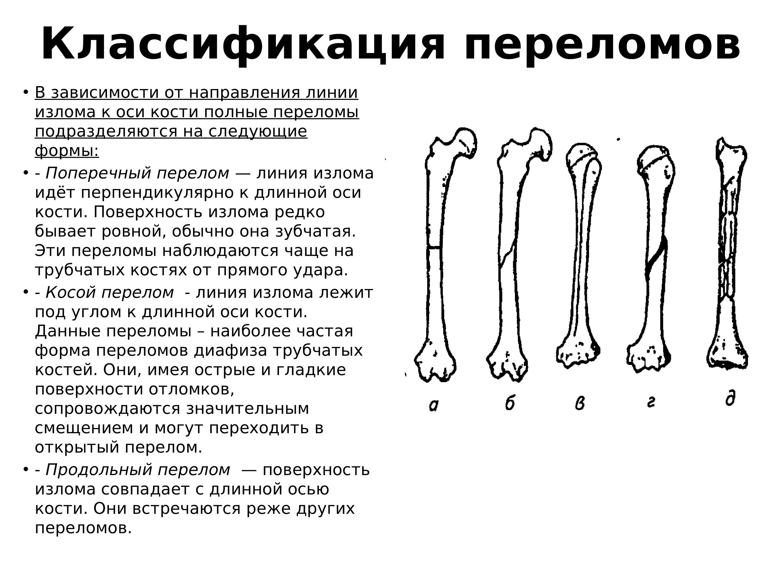 Перелом кости может быть каким. Переломы со смещением классификация. Виды переломов трубчатых костей по локализации. Перелом диафиза бедренной кости классификация. Виды переломов костей конечностей классификация.