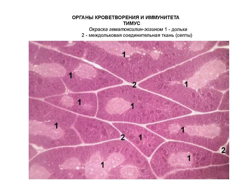 Зобная железа гистология препарат. Вилочковая железа гистология препарат. Тимус гематоксилин эозин. Тимус гистология препарат. Органы кроветворения иммунной