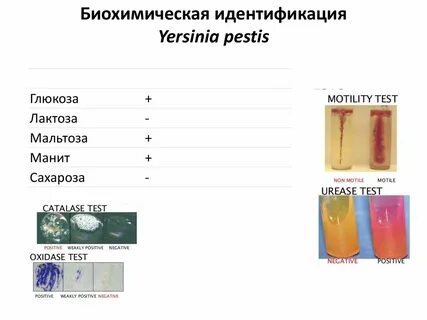 Чума тест