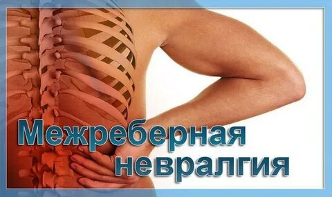 Снять межреберную невралгию таблетки